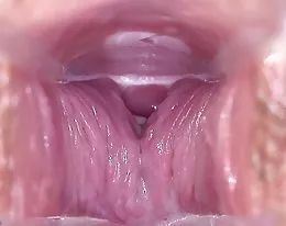 Sandra - Speculum Close-up