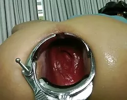 HOTKINKYJO - elbow deep fisting prolapse speculum extreme