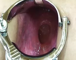 Elmer wife extreme anal speculum play